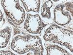 DDR1 Antibody in Immunohistochemistry (Paraffin) (IHC (P))