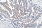 DDR1 Antibody in Immunohistochemistry (Paraffin) (IHC (P))