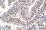 DDR1 Antibody in Immunohistochemistry (Paraffin) (IHC (P))