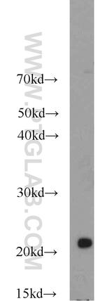 Dermatopontin Antibody in Western Blot (WB)