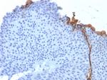 Uroplakin 3B (UPK3B) (Marker of Mesothelial and Umbrella Cells) Antibody in Immunohistochemistry (Paraffin) (IHC (P))