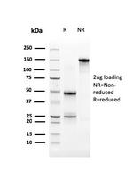 Uroplakin 3B (UPK3B) (Marker of Mesothelial and Umbrella Cells) Antibody in SDS-PAGE (SDS-PAGE)