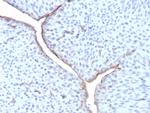 Uroplakin 3B (UPK3B) (Marker of Mesothelial and Umbrella Cells) Antibody in Immunohistochemistry (Paraffin) (IHC (P))