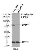 Calpain 1 Antibody in Western Blot (WB)