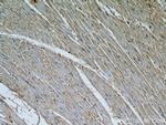 Calpain 1 Antibody in Immunohistochemistry (Paraffin) (IHC (P))