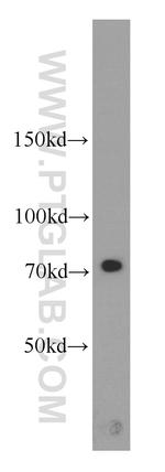 Calpain 1 Antibody in Western Blot (WB)