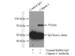 Calpain 1 Antibody in Immunoprecipitation (IP)