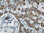 MAOA Antibody in Immunohistochemistry (Paraffin) (IHC (P))