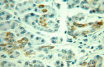 MAOA Antibody in Immunohistochemistry (Paraffin) (IHC (P))