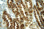 MAOA Antibody in Immunohistochemistry (Paraffin) (IHC (P))