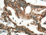 MAOA Antibody in Immunohistochemistry (Paraffin) (IHC (P))