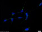 RABAC1 Antibody in Immunocytochemistry (ICC/IF)