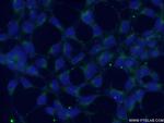 RABAC1 Antibody in Immunocytochemistry (ICC/IF)