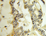 RABAC1 Antibody in Immunohistochemistry (Paraffin) (IHC (P))