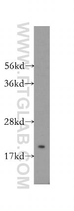 RABAC1 Antibody in Western Blot (WB)