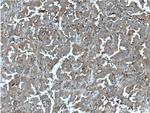 PSME1 Antibody in Immunohistochemistry (Paraffin) (IHC (P))