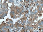 PSME1 Antibody in Immunohistochemistry (Paraffin) (IHC (P))