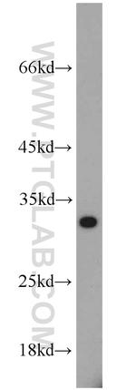 PSME1 Antibody in Western Blot (WB)