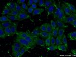 peroxiredoxin 2 Antibody in Immunocytochemistry (ICC/IF)