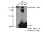 peroxiredoxin 2 Antibody in Immunoprecipitation (IP)