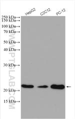 peroxiredoxin 2 Antibody in Western Blot (WB)