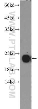 peroxiredoxin 2 Antibody in Western Blot (WB)
