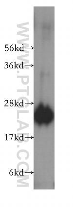 peroxiredoxin 2 Antibody in Western Blot (WB)