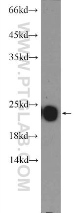 peroxiredoxin 2 Antibody in Western Blot (WB)