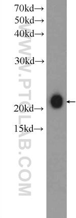 peroxiredoxin 2 Antibody in Western Blot (WB)