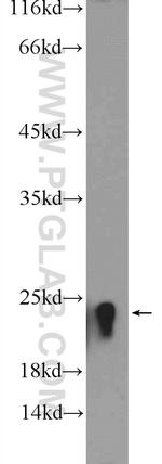 peroxiredoxin 2 Antibody in Western Blot (WB)