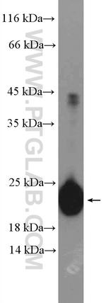 peroxiredoxin 2 Antibody in Western Blot (WB)