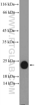 peroxiredoxin 2 Antibody in Western Blot (WB)