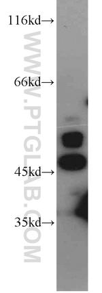 IRF5 Antibody in Western Blot (WB)