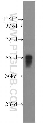 IRF5 Antibody in Western Blot (WB)