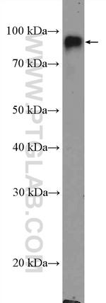 CD18 Antibody in Western Blot (WB)