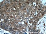 NCL Antibody in Immunohistochemistry (Paraffin) (IHC (P))