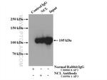 NCL Antibody in Immunoprecipitation (IP)