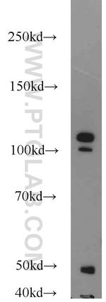 NCL Antibody in Western Blot (WB)