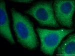 GYS1 Antibody in Immunocytochemistry (ICC/IF)