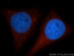 GYS1 Antibody in Immunocytochemistry (ICC/IF)