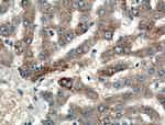 GYS1 Antibody in Immunohistochemistry (Paraffin) (IHC (P))