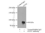 GYS1 Antibody in Immunoprecipitation (IP)