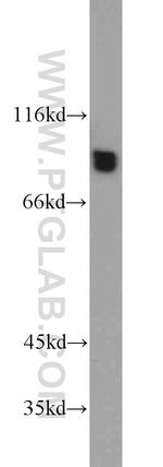 GYS1 Antibody in Western Blot (WB)