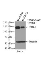 Integrin alpha-5 Antibody in Western Blot (WB)