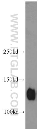 Integrin alpha-5 Antibody in Western Blot (WB)