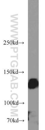 Integrin alpha-5 Antibody in Western Blot (WB)