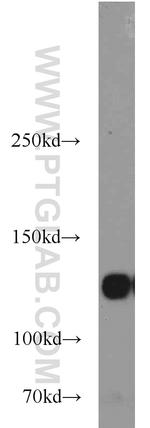 Integrin alpha-5 Antibody in Western Blot (WB)