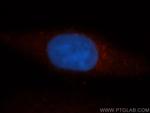 CCT3 Antibody in Immunocytochemistry (ICC/IF)