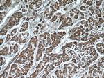 CCT3 Antibody in Immunohistochemistry (Paraffin) (IHC (P))