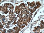 CCT3 Antibody in Immunohistochemistry (Paraffin) (IHC (P))